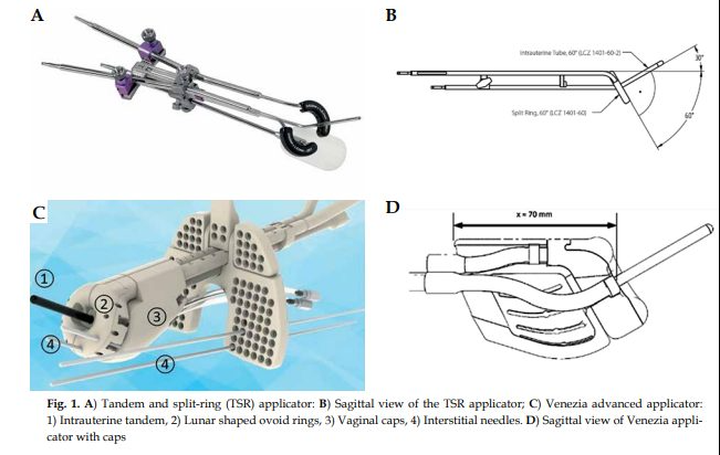 the applicator inclusion in considered clinical volumes should be mentioned when reporting dose-volume histogram (DVH) parameters.
termedia.pl/Effect-of-appl…