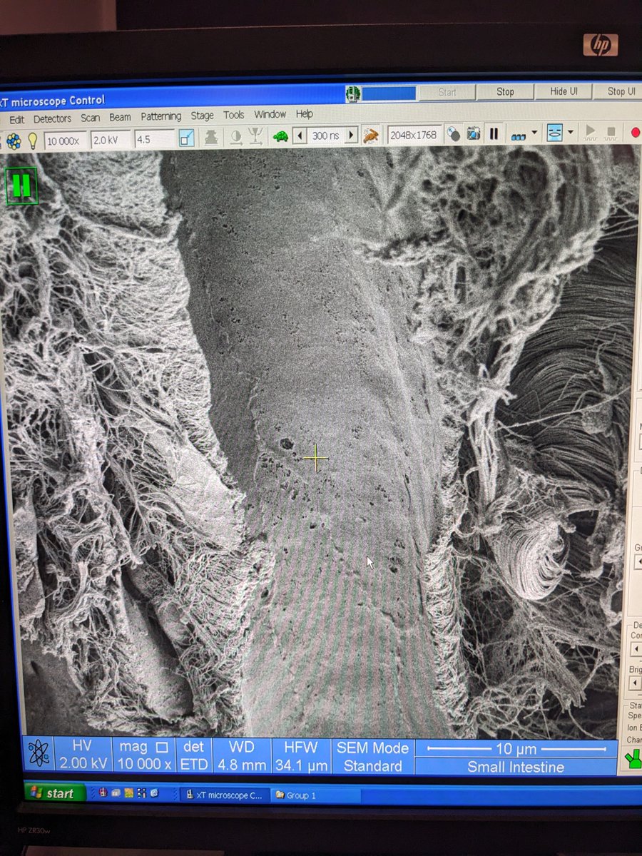 SorenGrubb's tweet image. 🎉 Just finished a fantastic course in electron microscopy at @UCPH_health's CFIM! 🎓 Highly recommend! Here's a thread 🧵 of some cool images we took. First up, an SEM image of a blood vessel in a small intestine. 🤩 #EM_Monday #ElectronMicroscopy