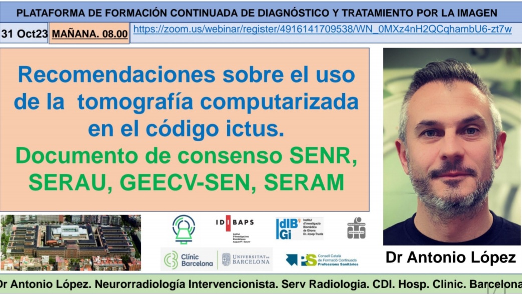 @RevistaRADIOLOGIA (@revistaradiolo2) on Twitter photo No te pierdas mañana a <a href="/AntonioLR81/">Antonio López-Rueda</a> hablar de su artículo publicado en <a href="/RevistaRADIOLO2/">@RevistaRADIOLOGIA</a> sobre la TC en el código ictus. Un documento de consenso avalado por <a href="/SENR_org/">SENR_org</a> <a href="/seneurologia/">SEN</a> <a href="/SERAUWeb/">SERAU</a> y <a href="/SERAM_RX/">SERAM - Sociedad Española de Radiología Médica</a> ¡Descarga el artículo y conéctate mañana!
elsevier.es/es-revista-rad… No te pierdas mañana a <a href="/AntonioLR81/">Antonio López-Rueda</a> hablar de su artículo publicado en <a href="/RevistaRADIOLO2/">@RevistaRADIOLOGIA</a> sobre la TC en el código ictus. Un documento de consenso avalado por <a href="/SENR_org/">SENR_org</a> <a href="/seneurologia/">SEN</a> <a href="/SERAUWeb/">SERAU</a> y <a href="/SERAM_RX/">SERAM - Sociedad Española de Radiología Médica</a> ¡Descarga el artículo y conéctate mañana!
elsevier.es/es-revista-rad…