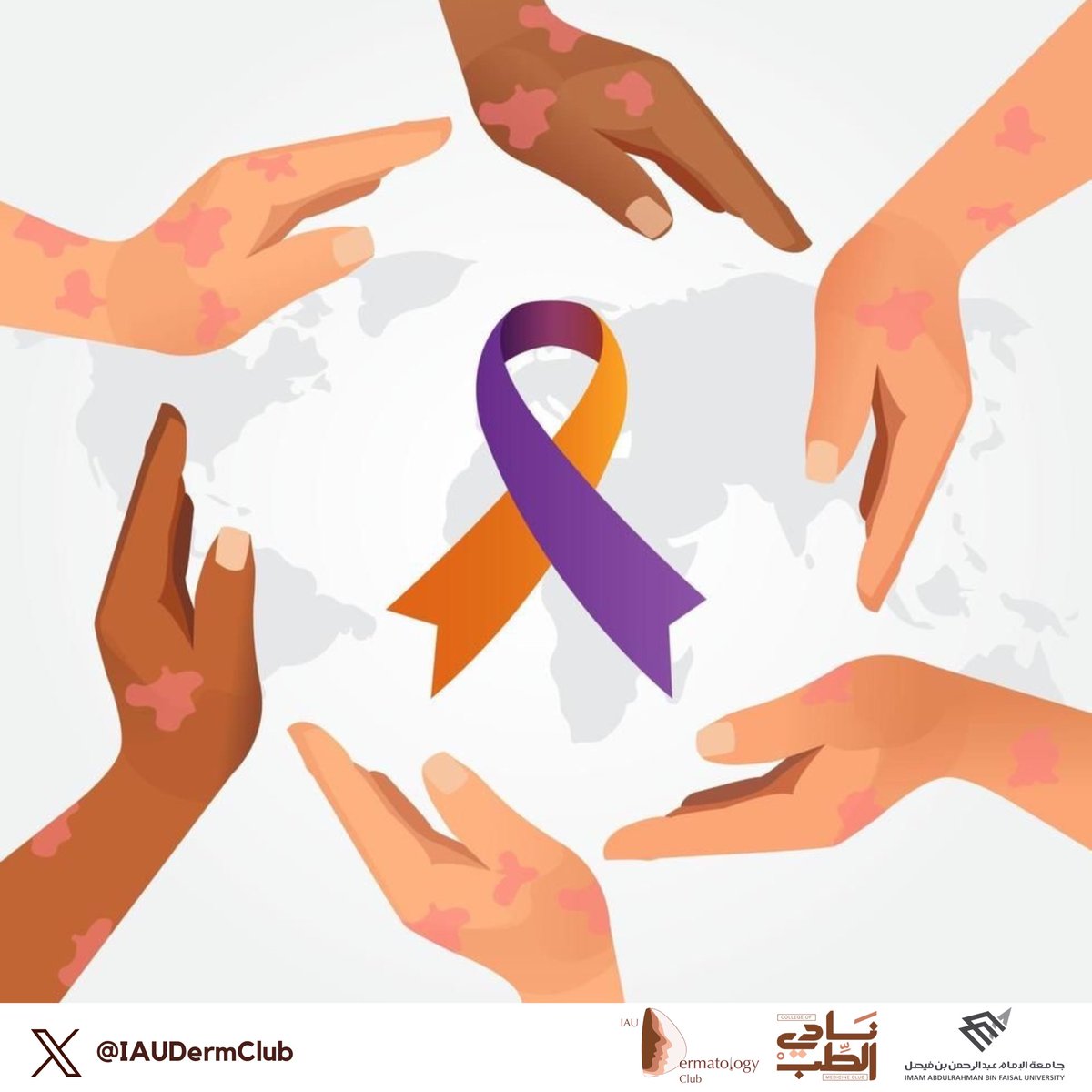 On the 29th of October we come together as a community to raise awareness and show support for those living with psoriasis. Let’s extend our hands in compassion with those who bravely face the challenges of psoriasis every day.

#WorldPsoriasisDay