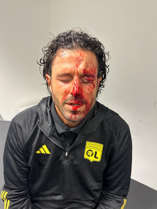 fabio grosso sanguinante sul viso