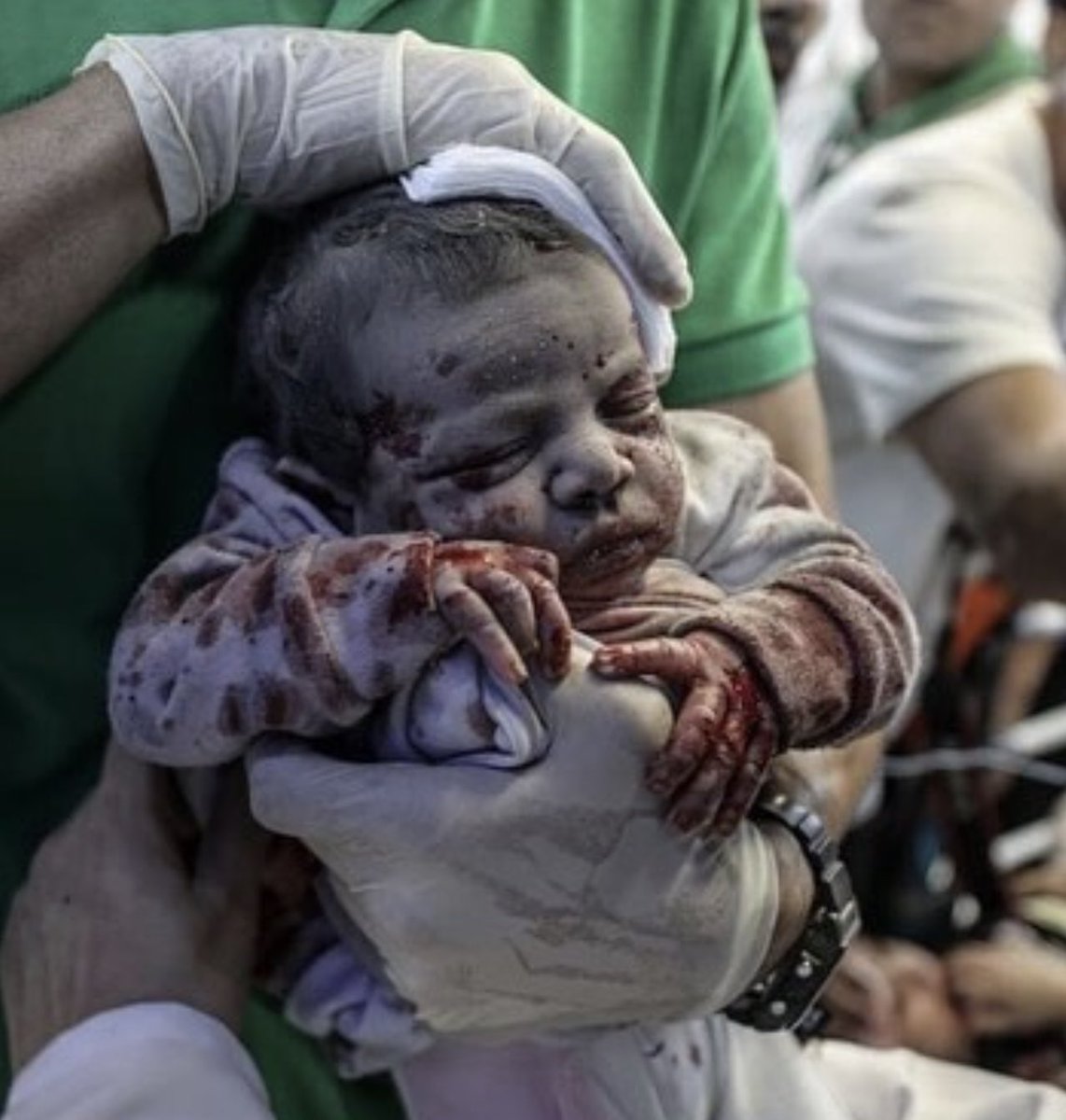 Sembra appena nato ma sta per morire. Quasi 4000 bambini trucidati a Gaza. Una mattanza che a nessun paese sarebbe consentita. Tranne ad Israele. #CeaseFireInGaza