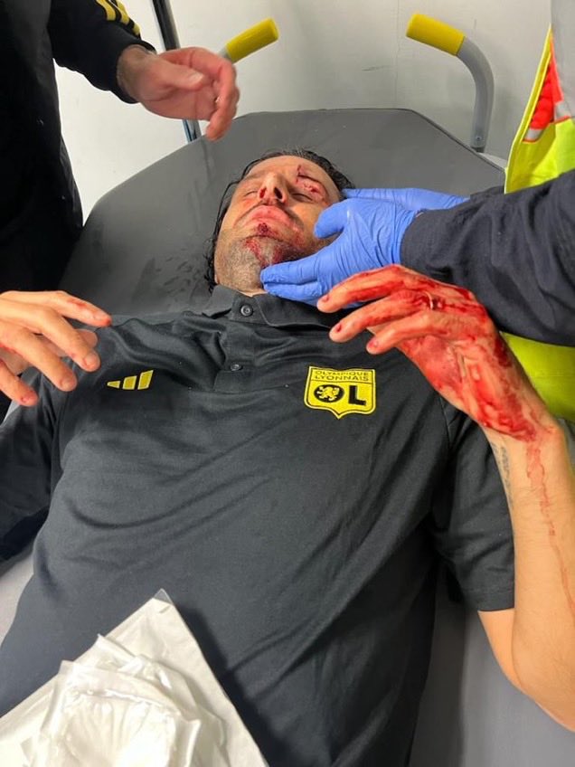 Jebalibrahim11's tweet photo. La honte il faut sévir comme en Angleterre soutien à Fabio grosso les joueurs et son staf Allez lOM https://t.co/mQh9lysBx7