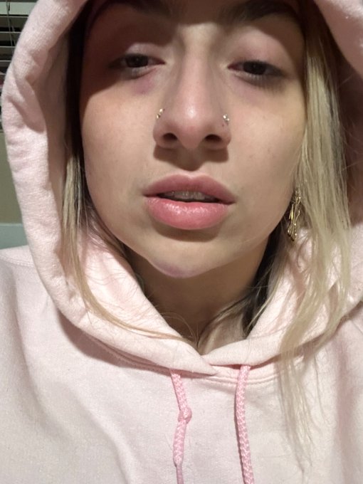 MUTUAL AID REQUEST:  earlier this month, i got jumped by 5+ men &amp; kicked in the jaw --  landed in the