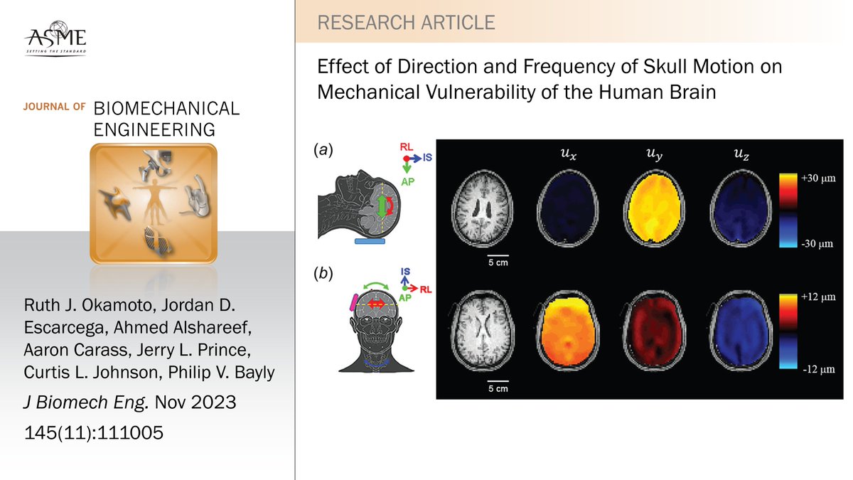 JBME Editors (@jbmejournal) on Twitter photo #newinJBME Brain magnetic resonance elastography reveals that lateral impacts are most likely to cause injury and suggests a new metric for injury vulnerability--the ratio of strain energy to kinetic energy. <a href="/WashUengineers/">WashU McKelvey Engineering</a> <a href="/HopkinsEngineer/">Johns Hopkins Engineering</a> <a href="/UDengineering/">UD Engineering</a> doi.org/10.1115/1.4062… #newinJBME Brain magnetic resonance elastography reveals that lateral impacts are most likely to cause injury and suggests a new metric for injury vulnerability--the ratio of strain energy to kinetic energy. <a href="/WashUengineers/">WashU McKelvey Engineering</a> <a href="/HopkinsEngineer/">Johns Hopkins Engineering</a> <a href="/UDengineering/">UD Engineering</a> doi.org/10.1115/1.4062…