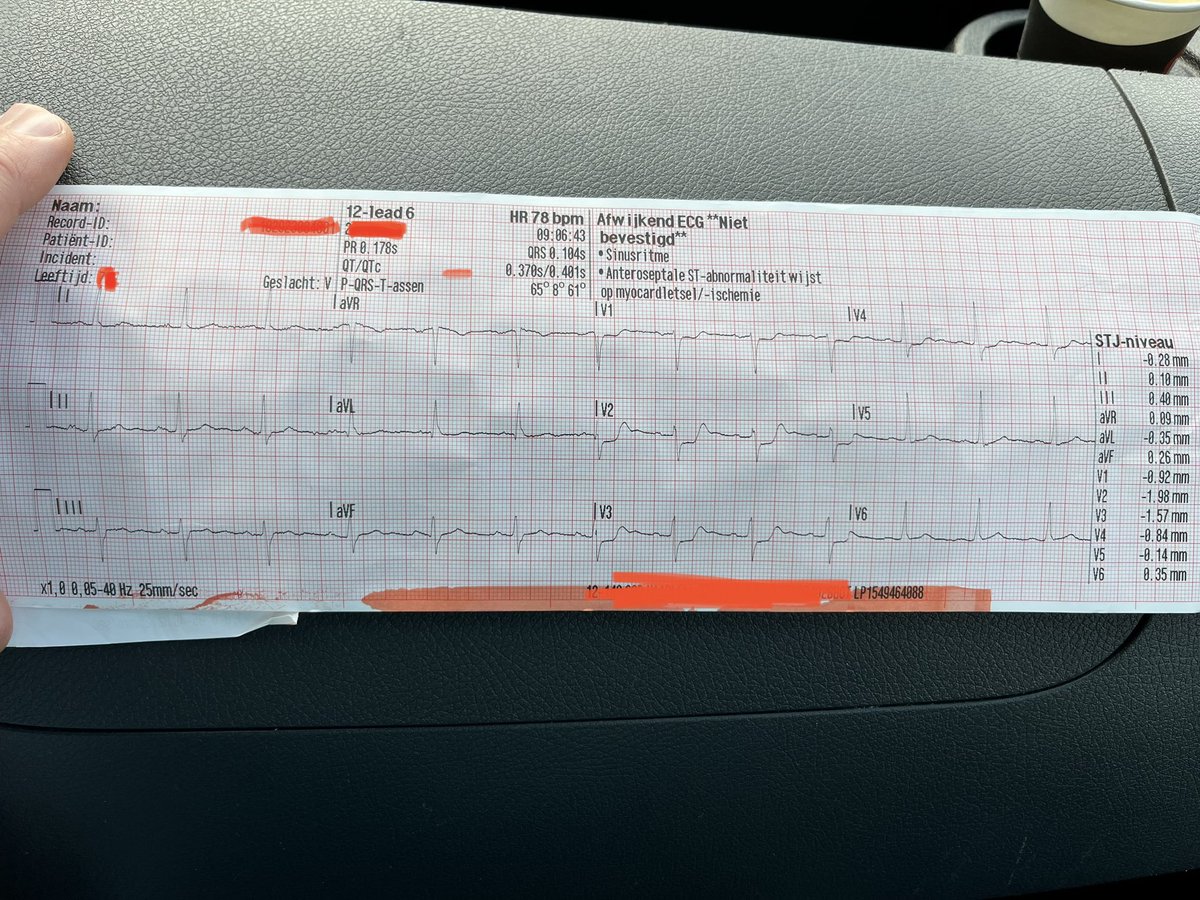 A 👵🏻 experiences sudden cp max within 2min and a sense of doom. 
Stable vitals, palpabel chestpain + excerbates with deep inspiration. Luckly we have some objective tools..
What would de the crullpit
 and why? 
#ecgtwitter #energencymedicine #ambulance #phnurse