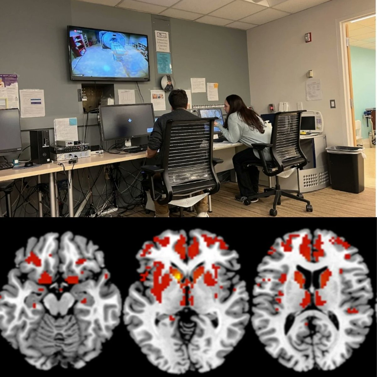 NMuseMed21's tweet photo. First participant in the Clinical Improvisatory Music for #Alzheimers and Cargivers (CIMAC) study started the intervention with the pre-intervention functional MRI evaluation.
#MusicIntervention
@NMuseMed21
@NUMesulamCenter
@NMNeurology
@NorthwesternMed
@NorthwesternU https://t.co/mkZembffl2