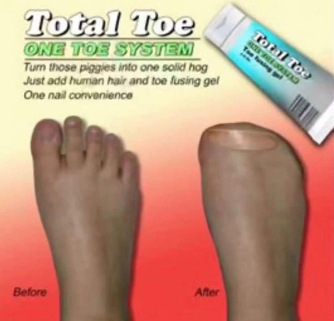PiernasTrace's tweet photo. @TT_Sunshine_ It works on camel toes too https://t.co/PctZG69evs