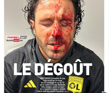 zazoomblog's tweet image. L’Equipe sbatte Grosso insanguinato in prima pagina (come si fanno i giornali) - #L’Equipe #sbatte #Grosso zazoom.it/2023-10-30/leq…