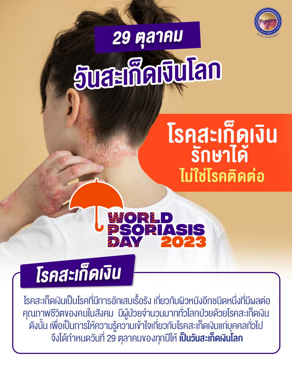 29 ตุลาคม วันสะเก็ดเงินโลก (World Psoriasis Day)
โรคสะเก็ดเงินรักษาได้ไม่ติดต่อ 👍✨
.
#วันสะเก็ดเงินโลก #สะเก็ดเงิน #psoriasis
#สมาคมแพทย์ผิวหนังแห่งประเทศไทย