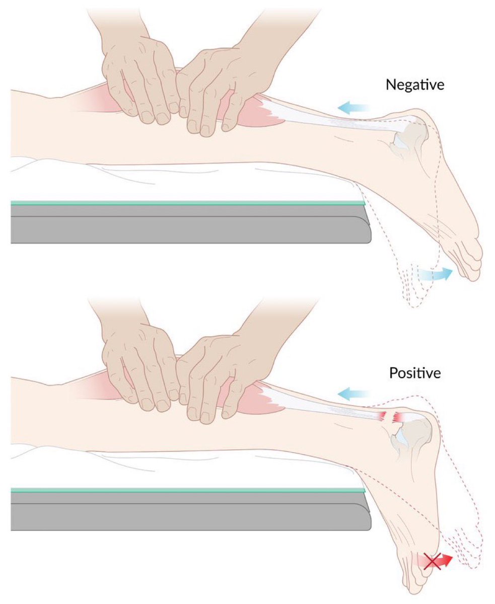 DrPharmDMDTh's tweet image. Name of test ? 

To assess what ?
