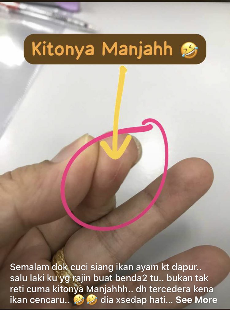 cikBJ's tweet photo. Smlm cuci siang ikan ayam..salu laki ku yg rajin buat benda2 tu..bkn tak reti cuma kitonya Manjahhh..dh tercedera kena ikan cencaru..🤣 dia xsedap hati kot aku kt dapur smlm..dia dtg tnya ok tak..aku ckp la ok..sbb belum settle.. lepastu baru mengadu tgn luka.. dalam wehh.. 🫣 https://t.co/CSeuNwzQjN