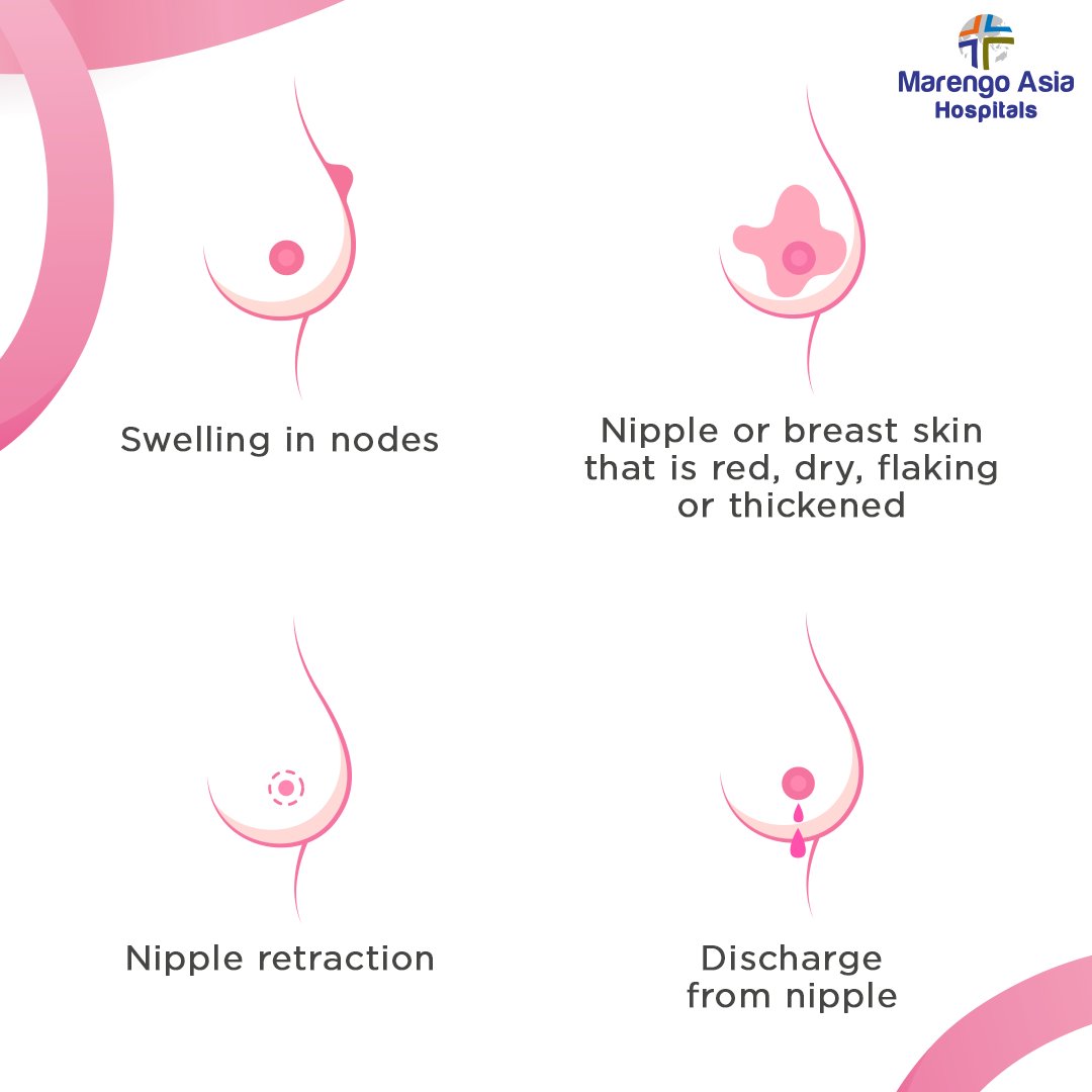 Marengo_Fbd's tweet photo. Understanding the symptoms of breast cancer can be life-changing. It's a reminder to ourselves and our loved ones that early detection is our greatest support. 

Join us in spreading this life-saving knowledge. 

#BreastCancerAwarenessMonth #CheckForChange #MarengoAsiaHospitals https://t.co/kfll5cE30C
