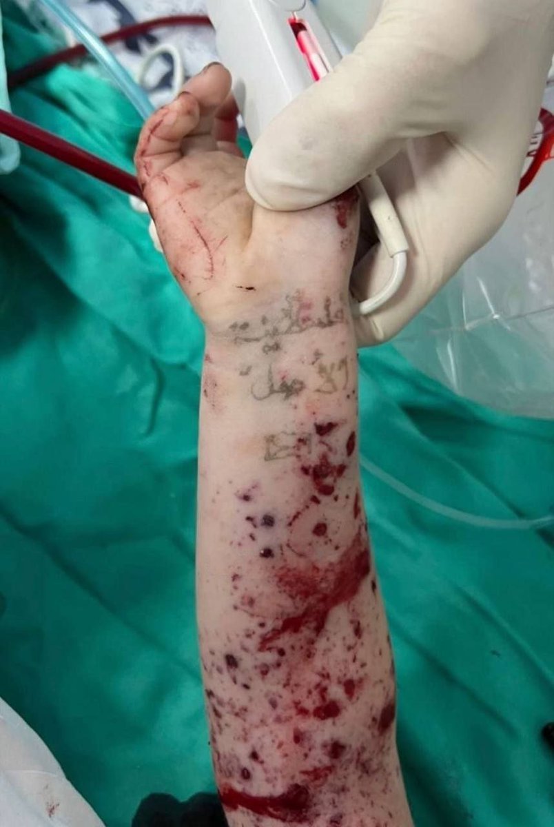 فلسطينية الأصل
طفلة نجت من القصف الإسرائيلي في قطاع #غزة.