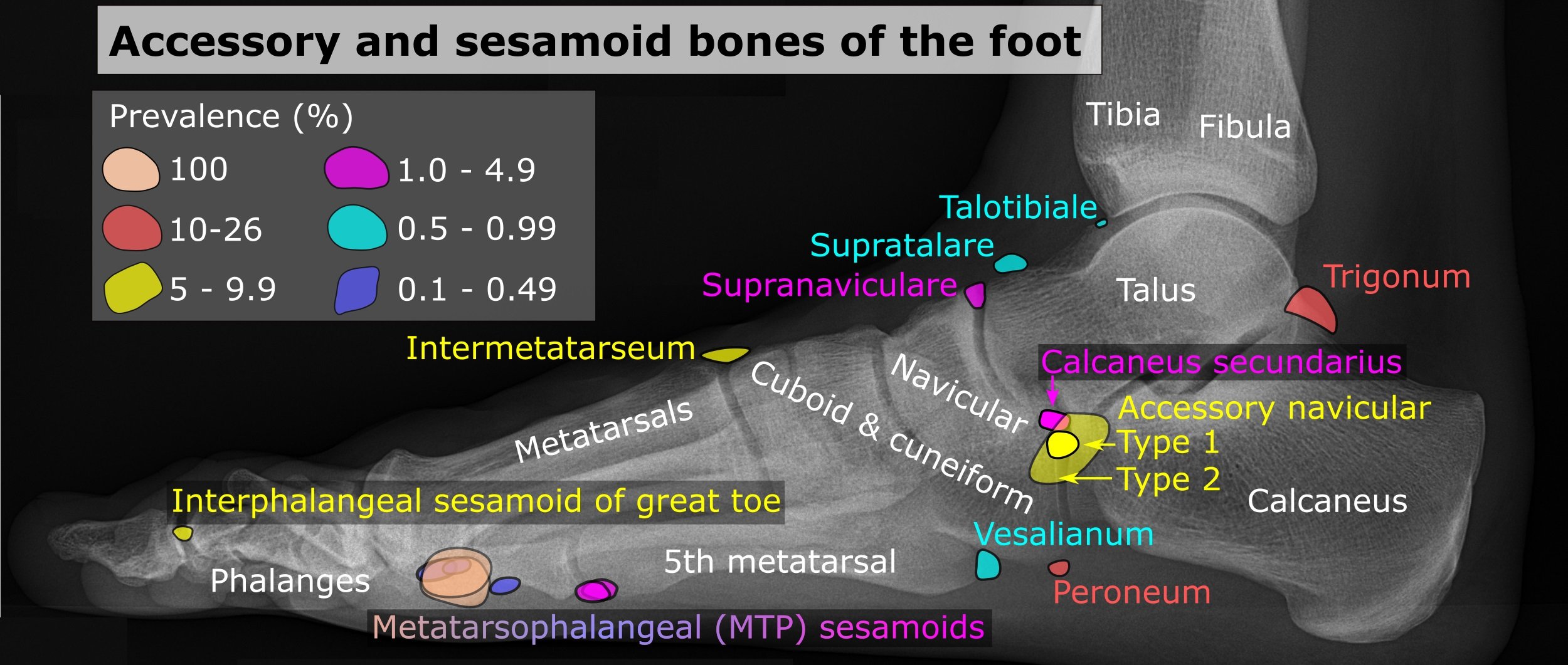 Ossicles - Wikipedia