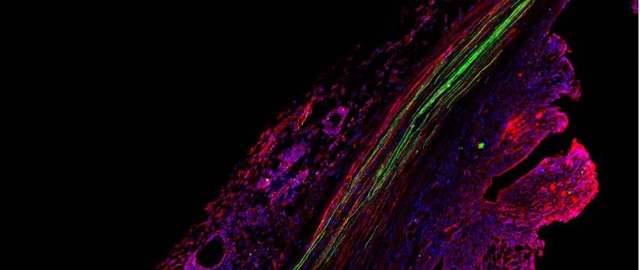 Descubren rol clave de células que impiden reparar daños al sistema nervioso periférico bit.ly/3MneFmK