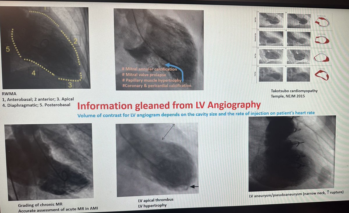 FOR FELLOWS 

LV angiography is a very useful tool that everyone should familiarize with. Here is all the information that can be obtained from this simple test.