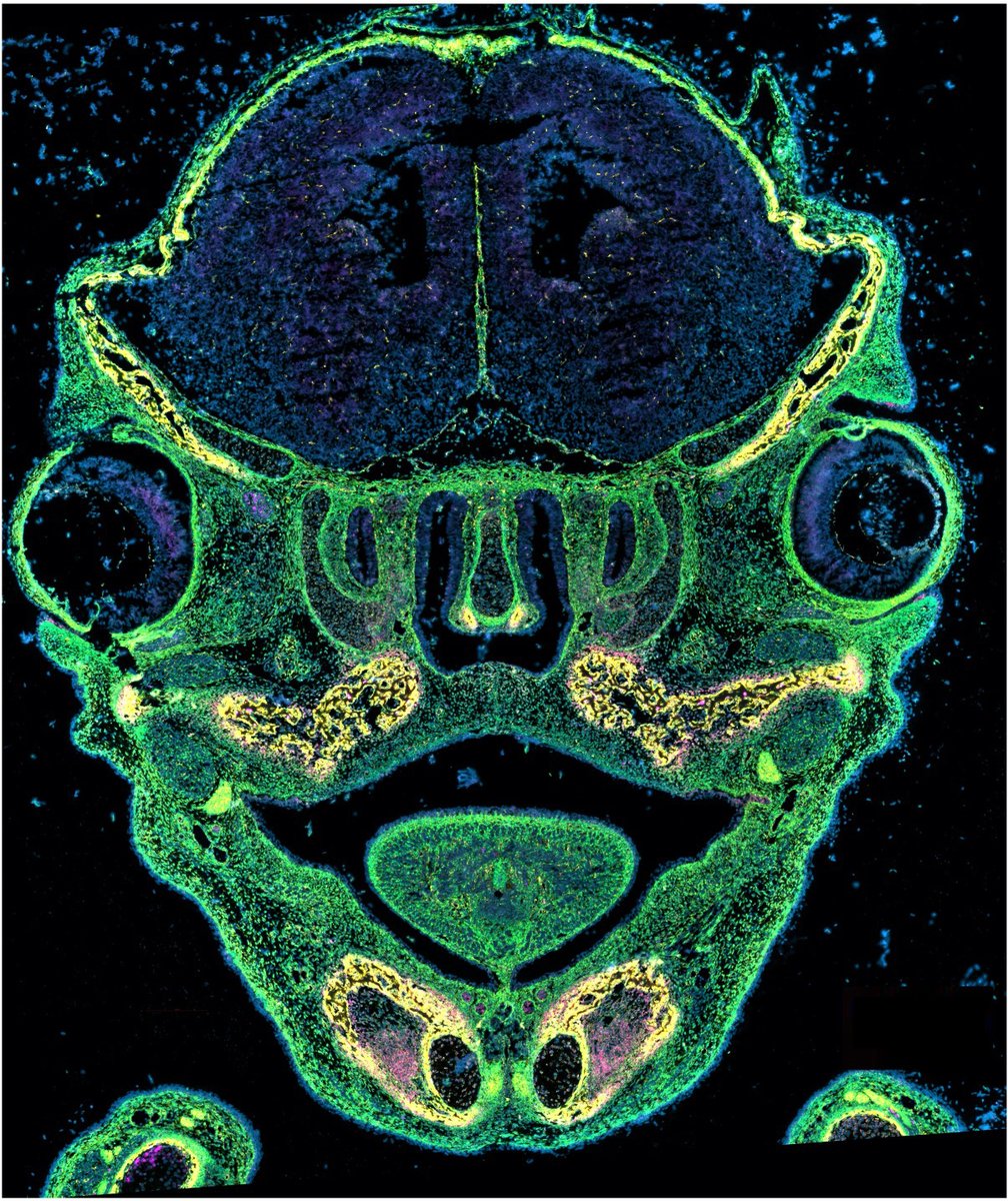 👽 This spooky face is no alien — it’s a mouse! #NIDCR Dir. Dr. D’Souza’s lab @NICHD_NIH recently mapped how & when the roof of the mouth forms to separate oral & nasal cavities. The results could shed light on #cleftpalate, a common human birth anomaly go.nih.gov/vfWlBnE