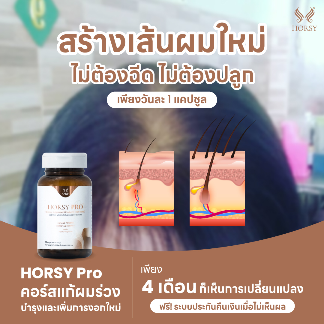 OPHairCareOffi1's tweet photo. ไม่ต้องเก็บเงินปลูกผมเป็นปี ไม่ต้องมีเงินแสน ผู้หญิงอย่างเราก็แก้ปัญหารอยแสกกว้างได้นะ #บอกต่อของดี คอร์สแก้ผมร่วงของ HORSY Pro ตกวันละ 30 บาทเท่านั้น อันนี้เป็น #สูตรเฉพาะผู้หญิง และยังมี #ระบบรับประกันผลลัพธ์ #ไม่เห็นผลยินดีคืนเงิน* 

*เงื่อนไขเป็นไปตามที่บริษัทกำหนด https://t.co/mfrTPs0TCc