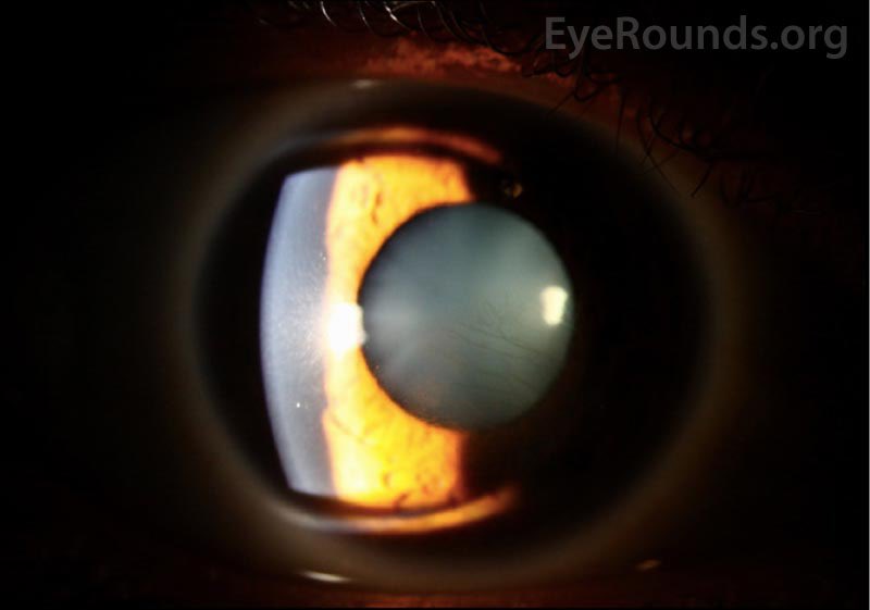 EyeRounds tweet media