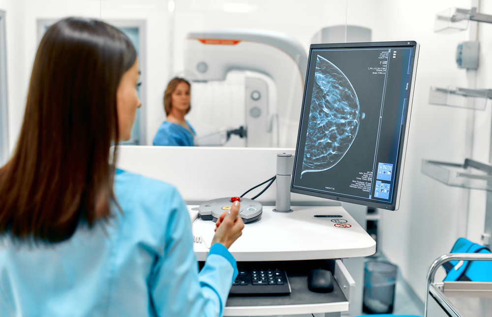 SIU Medicine (@siusom) on Twitter photo An estimated 1 in 8 American women will be diagnosed with breast cancer at some point in their lives. In May of this year, the USPSTF released a statement recommending that all women start screening with mammograms every other year, beginning at age 40: bit.ly/46JRkEg An estimated 1 in 8 American women will be diagnosed with breast cancer at some point in their lives. In May of this year, the USPSTF released a statement recommending that all women start screening with mammograms every other year, beginning at age 40: bit.ly/46JRkEg