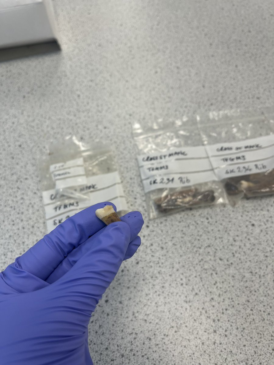 csblacka's tweet photo. Spent this afternoon acid etching some Victorian Human teeth! It felt very fitting foe the day before Halloween.

Also, how painful must that second tooth have been to have! https://t.co/7chI31ACSC