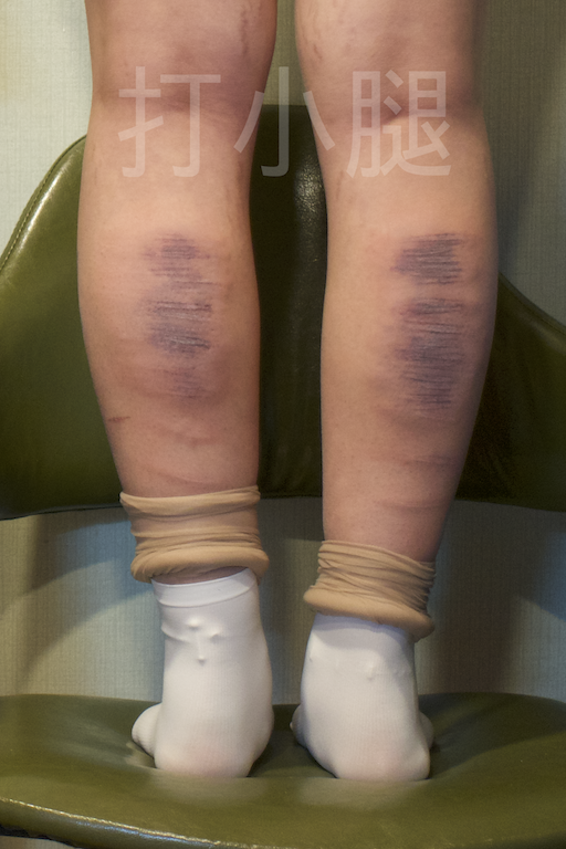 소개로 만나서 플을 했던 #펨키 . 플 자체가 처음이라고 했는데, #종아리 30대를 미동도 없이 잘 버텨냈던 놀라운 펨키였다..
