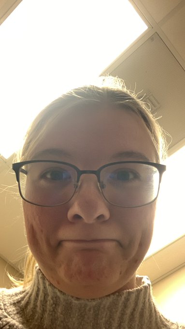 So um when I told the doctors about the whole dizziness and stuff when I stand up they immediately freaked<a href="/tag/mvsales"class="tags"><span>#mvsales</span></a>