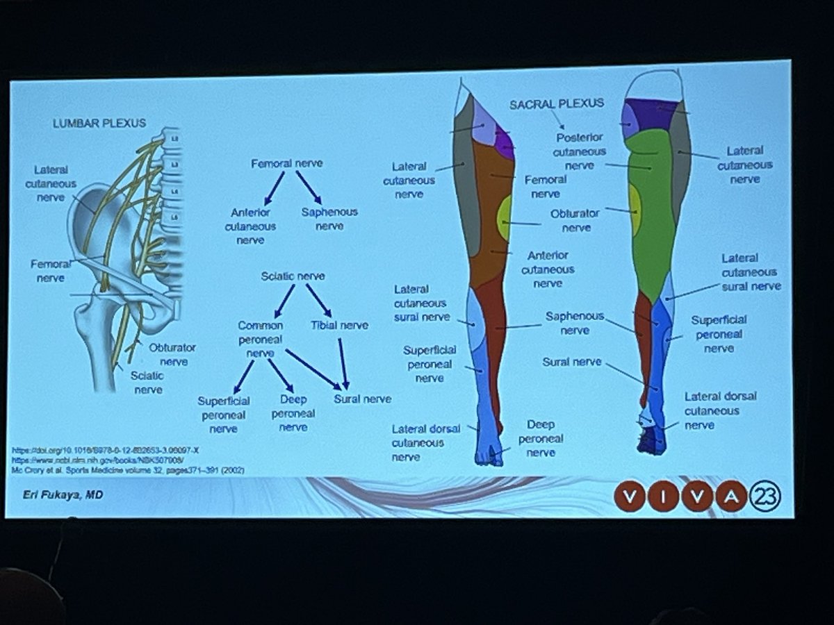 High yield slide by <a href="/EriFukayaMD/">Eri Fukaya</a>.  Cannot tell you how many times claudication is ultimately meralgia paresthetica or piriformis syndrome. Please don’t tell your patient .”Not vascular without offering definitive care/referral.” #AnchoringBias. #VIVA2023