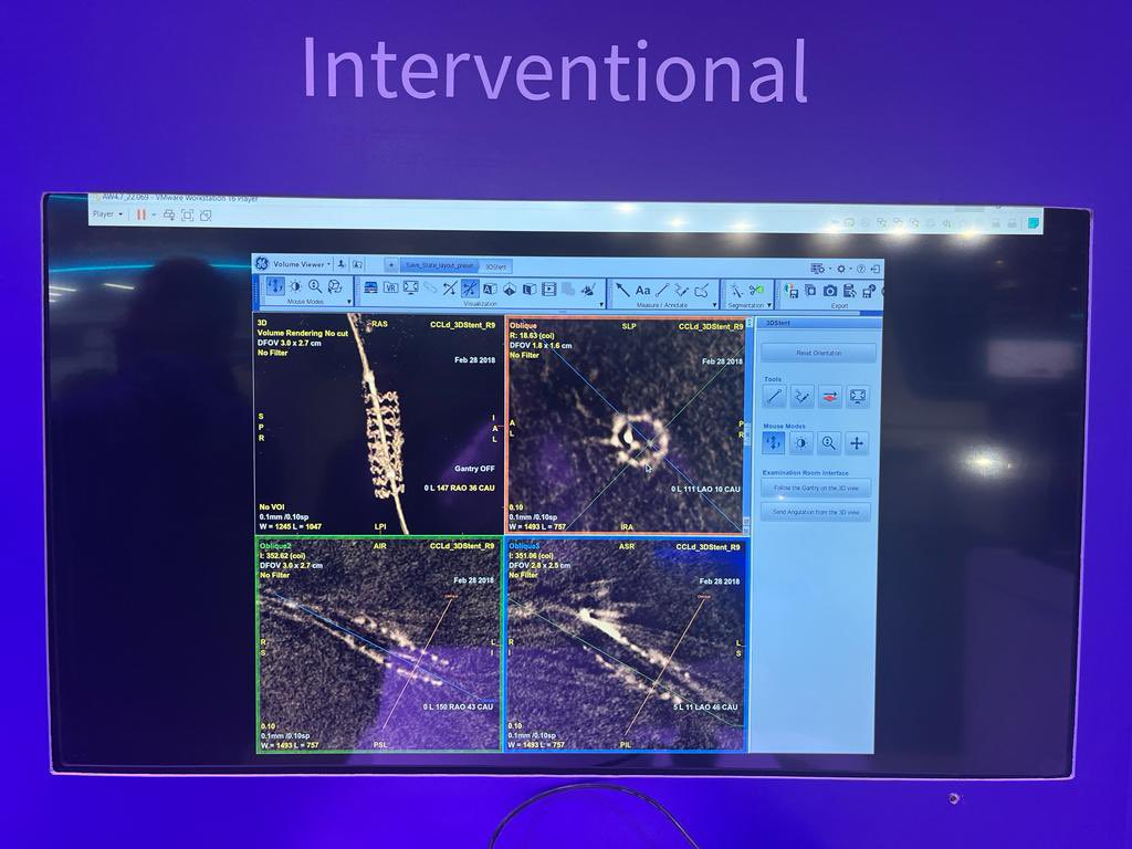Second day in #GlobalHealthExhibition interventional team having great fruitful customer engagements, Allia IGS 7 and 3D stent Demo is the highlight of this morning… 

Thank you to all who joined demos

#GEHC #3Dstent #Allia
