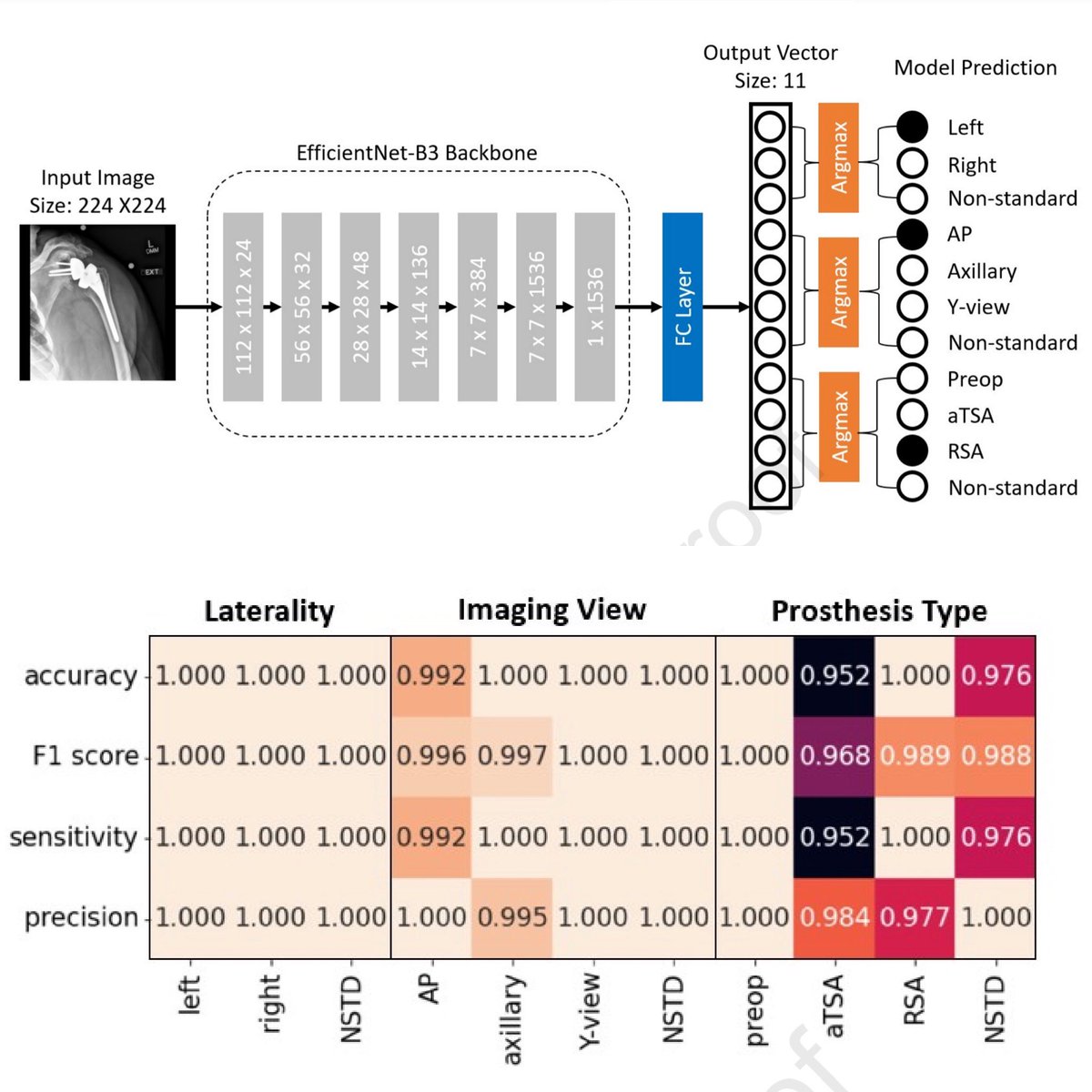 Thrilled to share the 1st step in our image based AI series where we developed an automated #deeplearning algorithm that can automatically classify and organize shoulder replacements based on laterality, radiograph projection, and implant type. 

📖 - pubmed.ncbi.nlm.nih.gov/37879598/