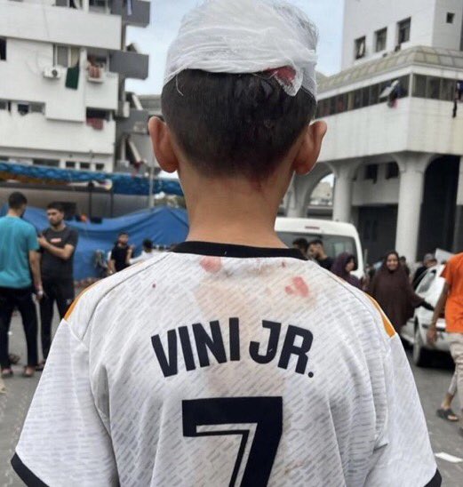 Those children of Gaza have ambitions and dreams, have favorite players, like any child in this world, but they were deprived of these simple rights and were exposed to the most severe types of violence due to the continuous Israeli bombing targeting these children
#BallonDor