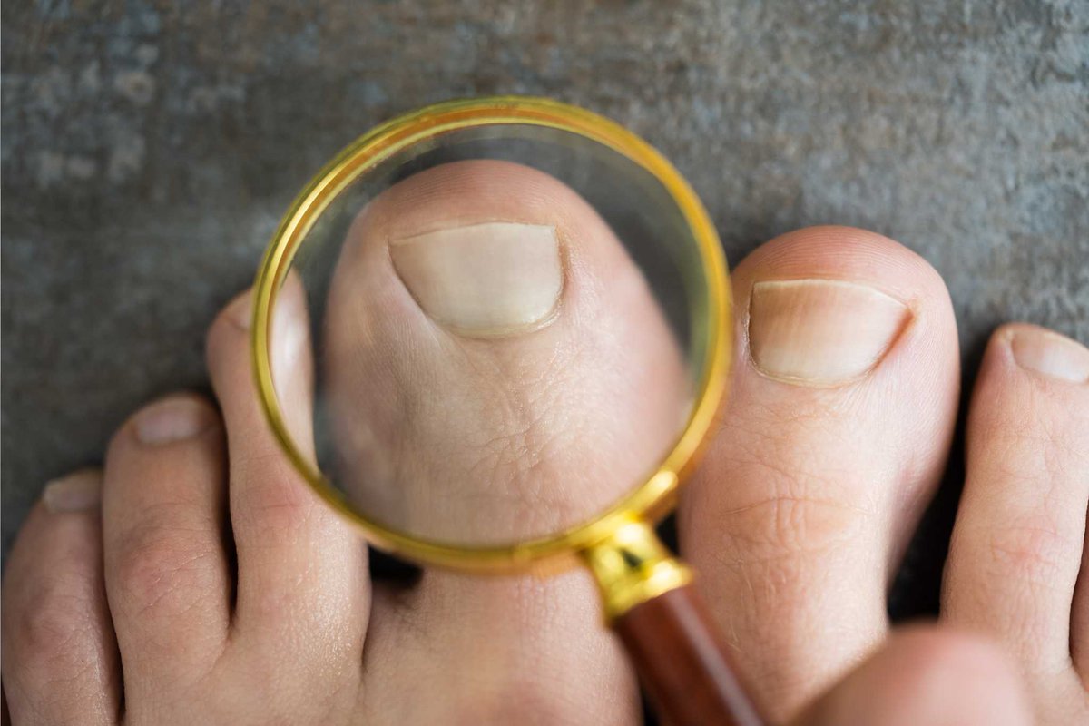 SoCalFootAnkle's tweet image. Stop suffering in silence! Our podiatrists are experienced in treating ingrown toenails. Schedule an appointment today and take the first step towards relief. #GetRelief #ExpertPodiatrists
bit.ly/3AYdm79