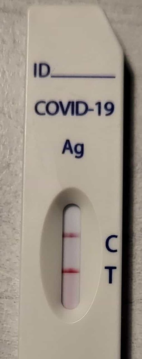 Höchstwahrscheinlich mein erster Kontakt mit diesem Mist. Seit einer Woche so das Gefühl, dass da eine Erkältung im Anzug sein könnte. Seit Samstag nicht mehr richtig arbeitsfähig. Test am Samstag war noch nicht positiv. Der heute explodierte geradezu, bevor die C feucht war...