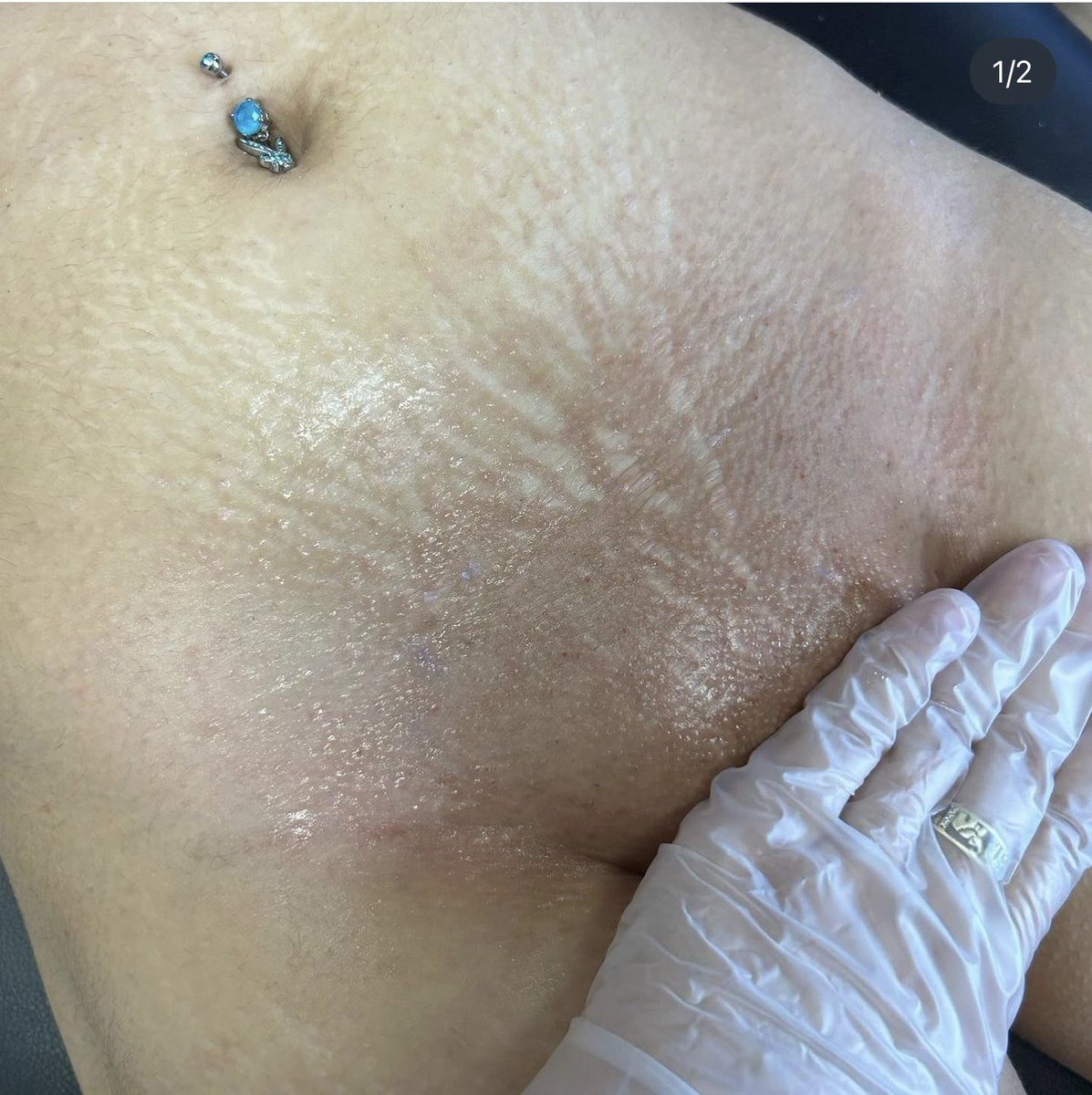 amparov47400111's tweet photo. I am a licensed esthetician located in the Dallas area who specializes in full body waxing, brow laminations &amp; bleaching 🤍

Come get ur coochie wax 🪄

Follow me on ig @Av.esthetics https://t.co/v2broR9z4x