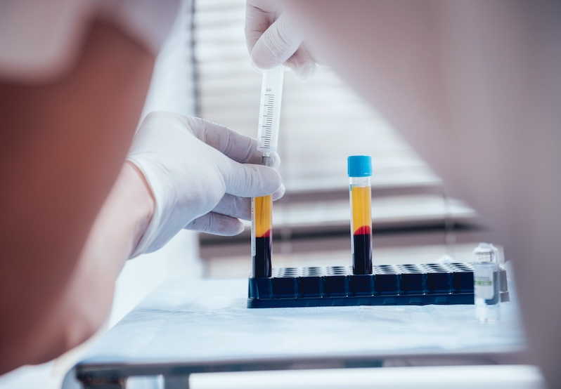 Conventional thinking is that platelets cause inflammation, but new research led by Dr. Heyu Ni, scientist at the Keenan Research Centre for Biomedical Sciences at St. Michael’s Hospital, found that they can also do the opposite. <a href="/hospitalnewscom/">Hospital News</a>  hospitalnews.com/engineered-pla…