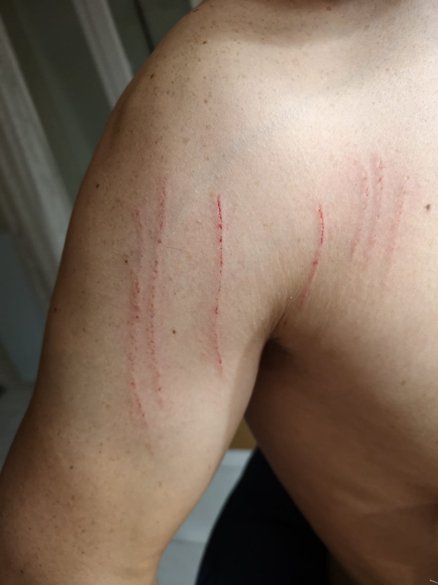 Sur l'échelle du foutage de gueule, vous croyez qu'elle est à combien ma nana lorsqu'elle dit qu'elle ne pensait pas qu' allumer l'aspirateur affolerait le gros chat craintif que j'avais dans les bras pour l'empêcher de sortir par la fenêtre alors qu'on fermait les volets ?