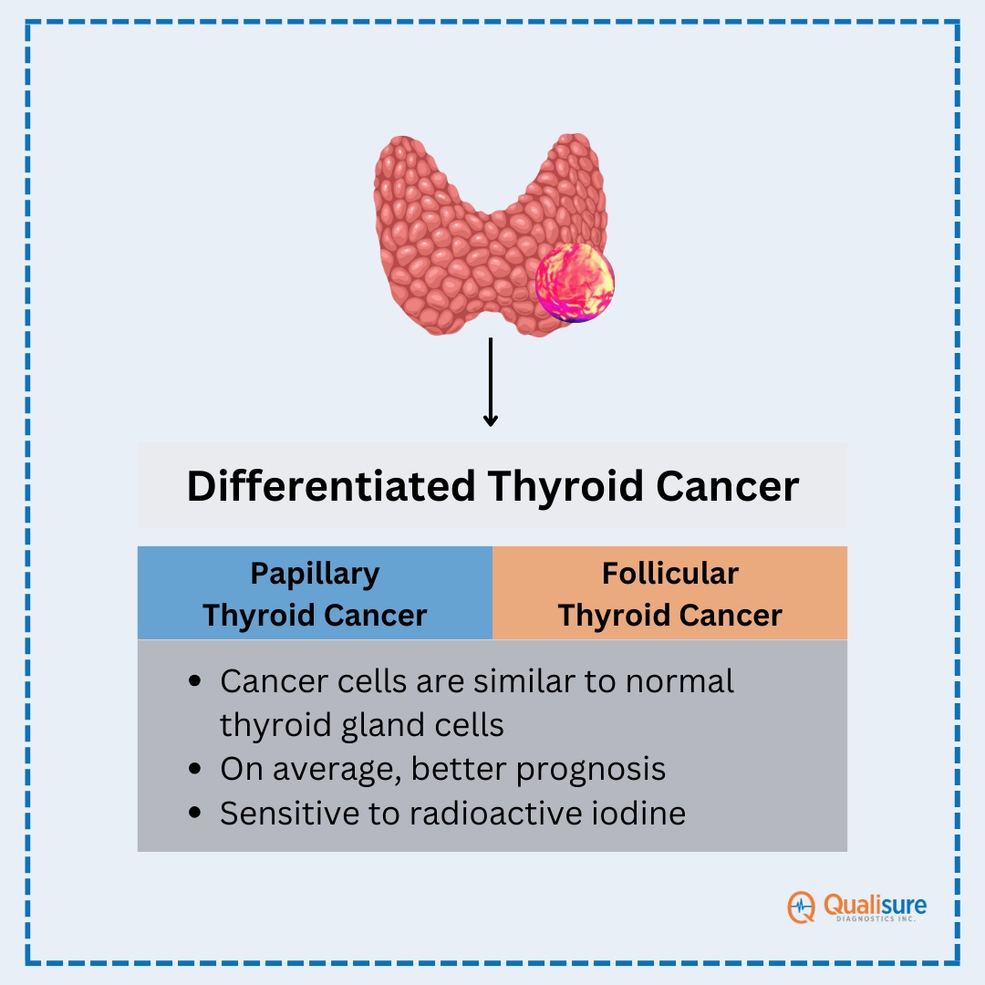 🦋 Wondering what it means to have #DifferentiatedThyroidCancer ? 🦋

Dive into our blog to understand treatment options, monitoring, and the personalized approach to tackle this unique form of #ThyroidCancer.

qualisuredx.com/differentiated…

#MedTwitter #EndoTwitter #ThyCa #Thyroid