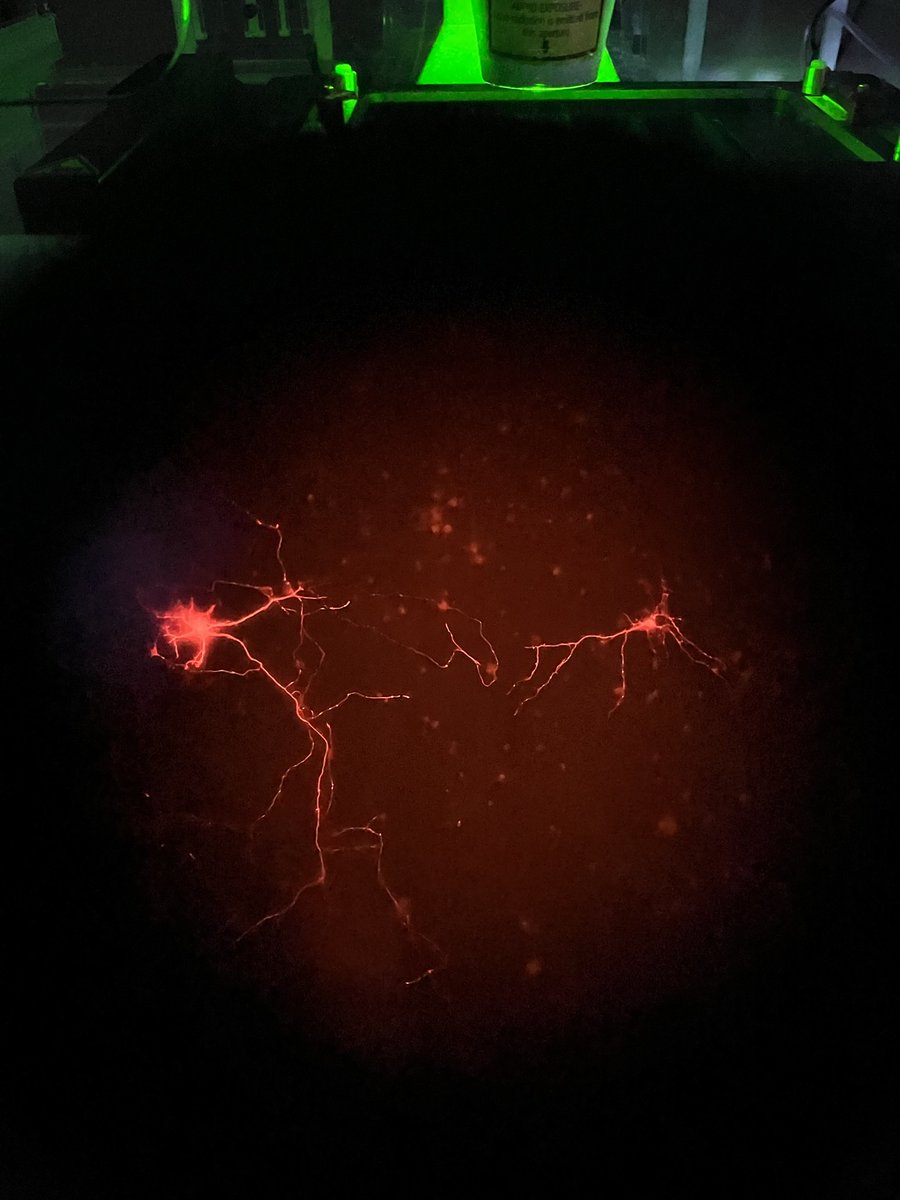 One of our graduated scholars, Melody Chao, is rocking her postbacc research at @JohnsHopkins, using cell culture to study Alzheimer's!

These are her cortical neurons that were transiently transfected with mCherry Rab5, captured through the lens of a confocal microscope. 💫🤩