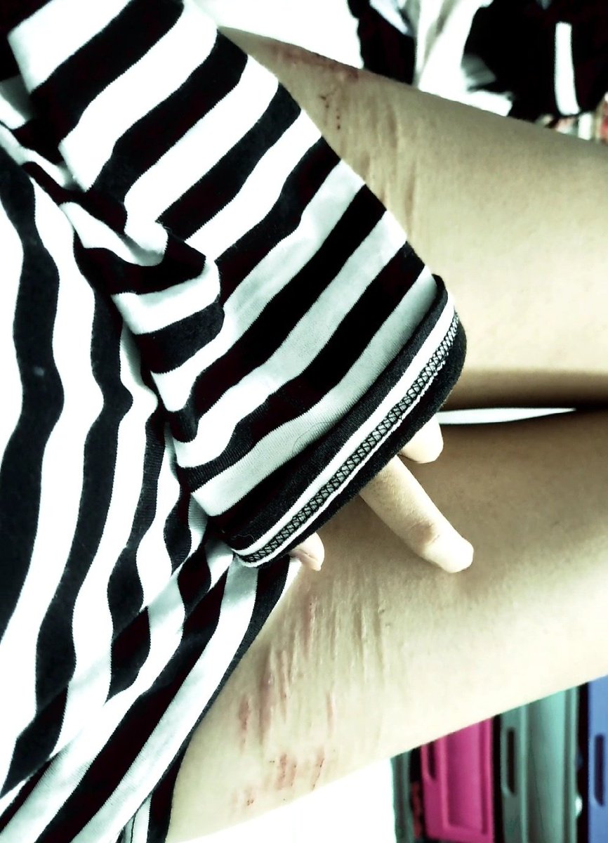 soobloding's tweet photo. pretty scarss https://t.co/vdAiiuRjI6