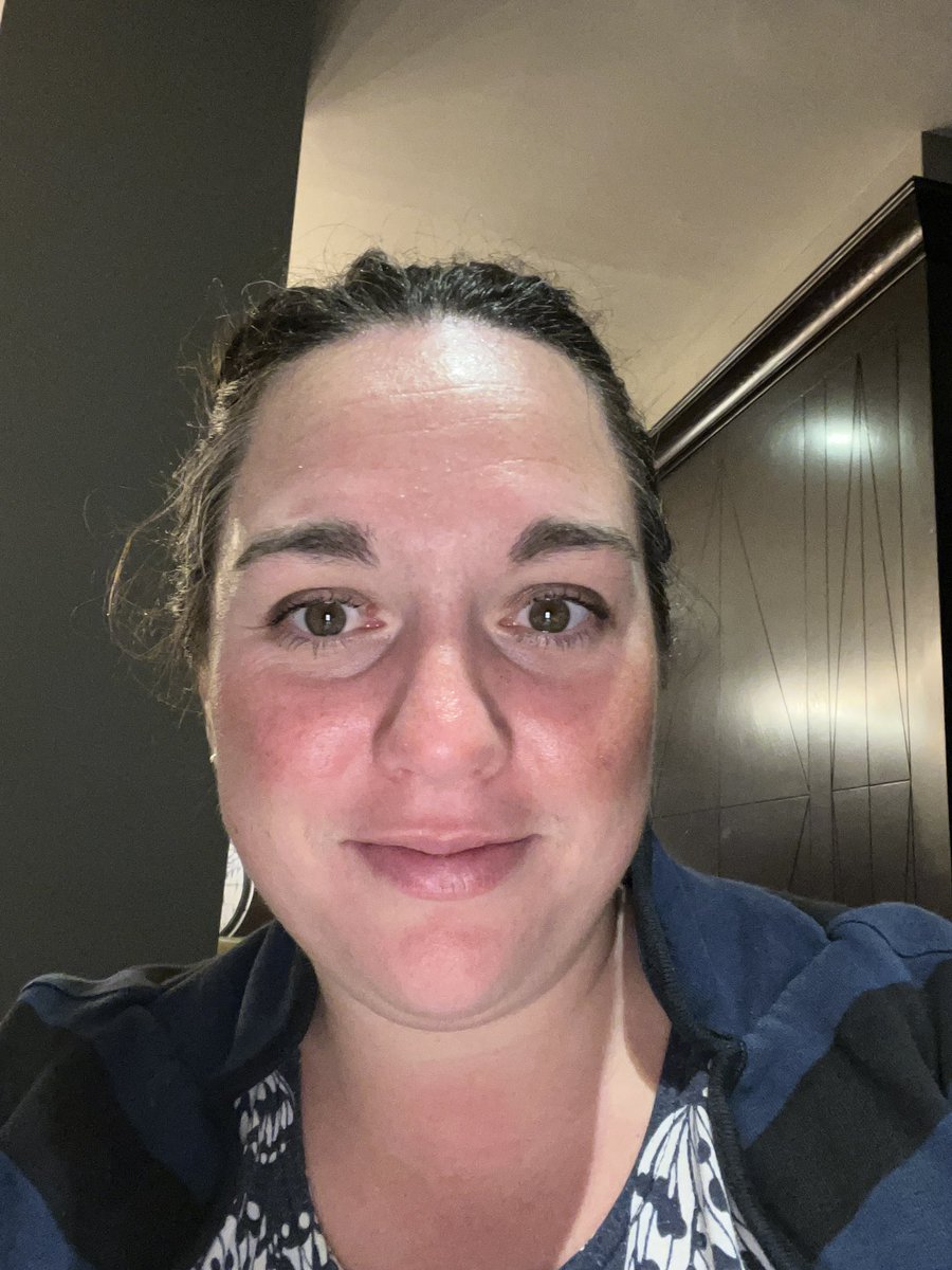 CharlotteKeave2's tweet image. Excited for a an interesting day today #wounds #networking #thinkingforward. #woundbalance