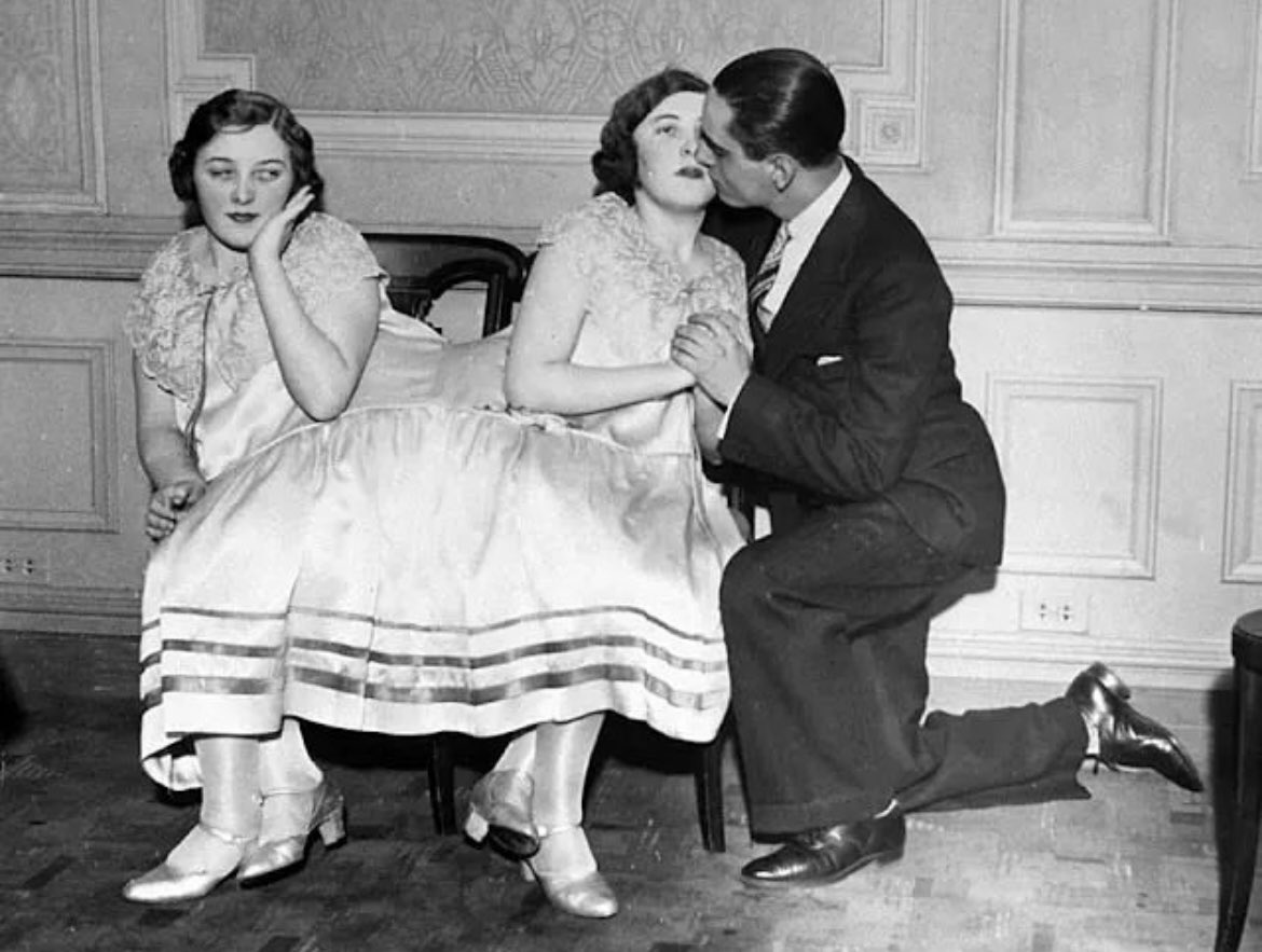 historyinmemes's tweet photo. In the 1940s, conjoined twins Margaret Gibb received a kiss from her boyfriend as her sister Mary observed. 

In 1966, it was revealed that Margaret had developed bladder cancer, which subsequently metastasized to her lungs over the following year.

Despite their health challenges, the twins steadfastly declined any surgical separation. On August 29, 1967, Margaret passed away, and two minutes later, Mary also passed away. They were both 55 years old.