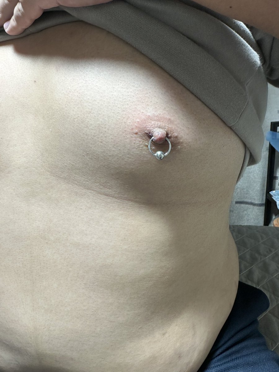 chenancai's tweet photo. #乳钉 #穿孔 #穿刺 #阴钉 乳钉完成 想要穿的可以联系我 https://t.co/2aDwUWmWm9