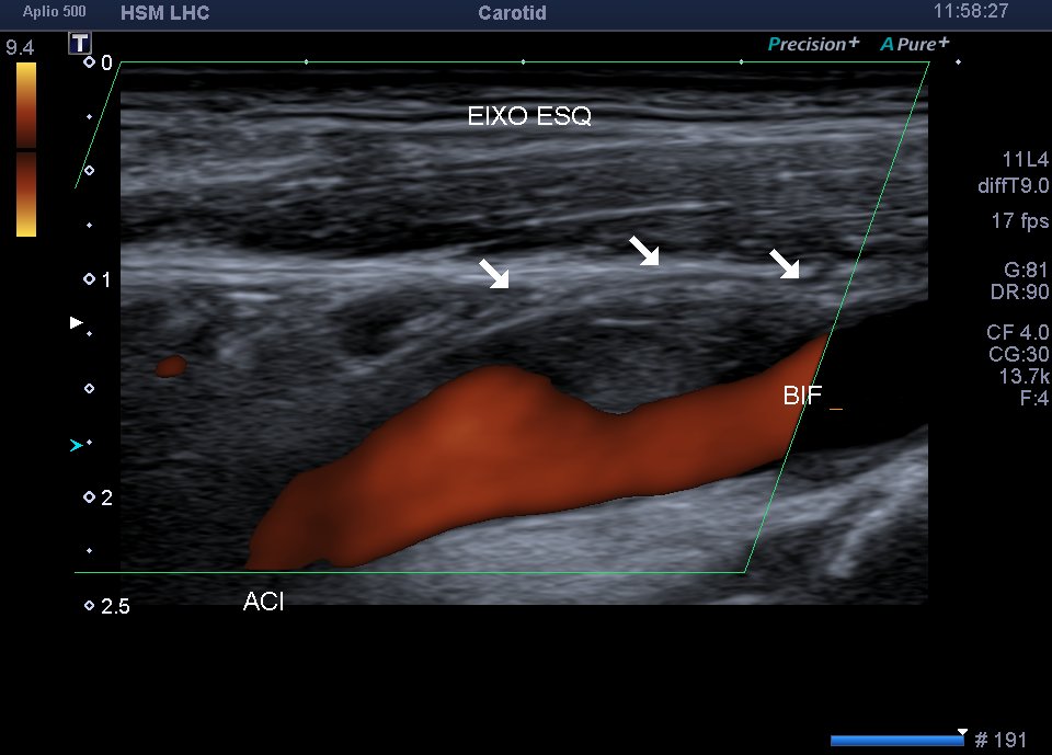Neurosonology Lab - LHC tweet media