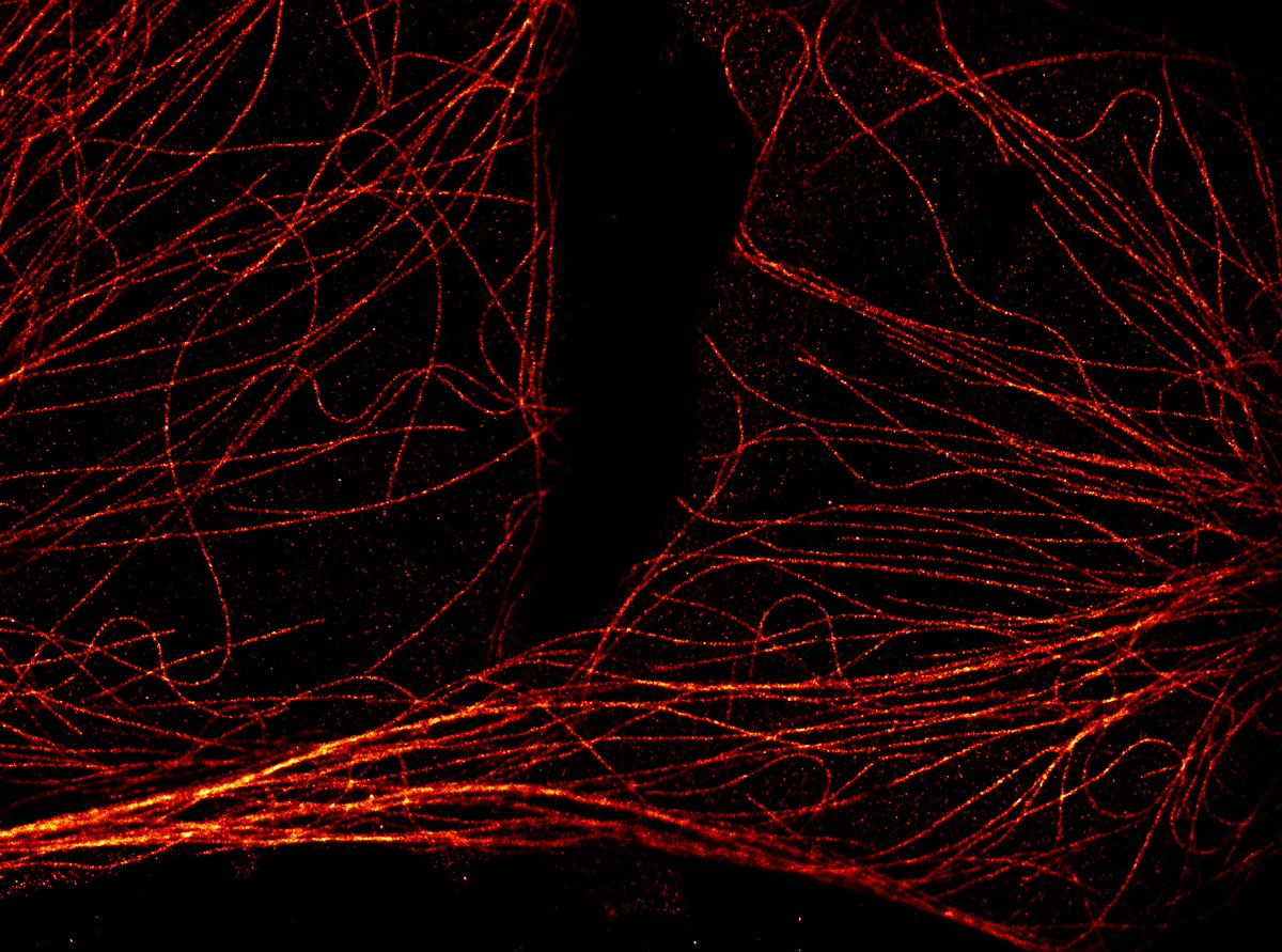 ESPCI Paris - PSL (@espci_paris) on Twitter photo 🔎 | Les capteurs de vision événementielle libèrent un potentiel inattendu pour l'imagerie de fluorescence à super-résolution <a href="/IzeddinResearch/">Ignacio Izeddin</a> <a href="/ClementCabriel/">Clément Cabriel</a>
▶️ nature.com/articles/s4156…
▶️ espci.psl.eu/fr/actualites/…
<a href="/ESPCI_Paris/">ESPCI Paris - PSL</a> <a href="/psl_univ/">Université PSL</a> <a href="/CNRS/">CNRS 🌍</a> <a href="/InstVisionParis/">Institut de la Vision</a>
<a href="/Inserm/">Inserm</a> 🔎 | Les capteurs de vision événementielle libèrent un potentiel inattendu pour l'imagerie de fluorescence à super-résolution <a href="/IzeddinResearch/">Ignacio Izeddin</a> <a href="/ClementCabriel/">Clément Cabriel</a>
▶️ nature.com/articles/s4156…
▶️ espci.psl.eu/fr/actualites/…
<a href="/ESPCI_Paris/">ESPCI Paris - PSL</a> <a href="/psl_univ/">Université PSL</a> <a href="/CNRS/">CNRS 🌍</a> <a href="/InstVisionParis/">Institut de la Vision</a>
<a href="/Inserm/">Inserm</a>