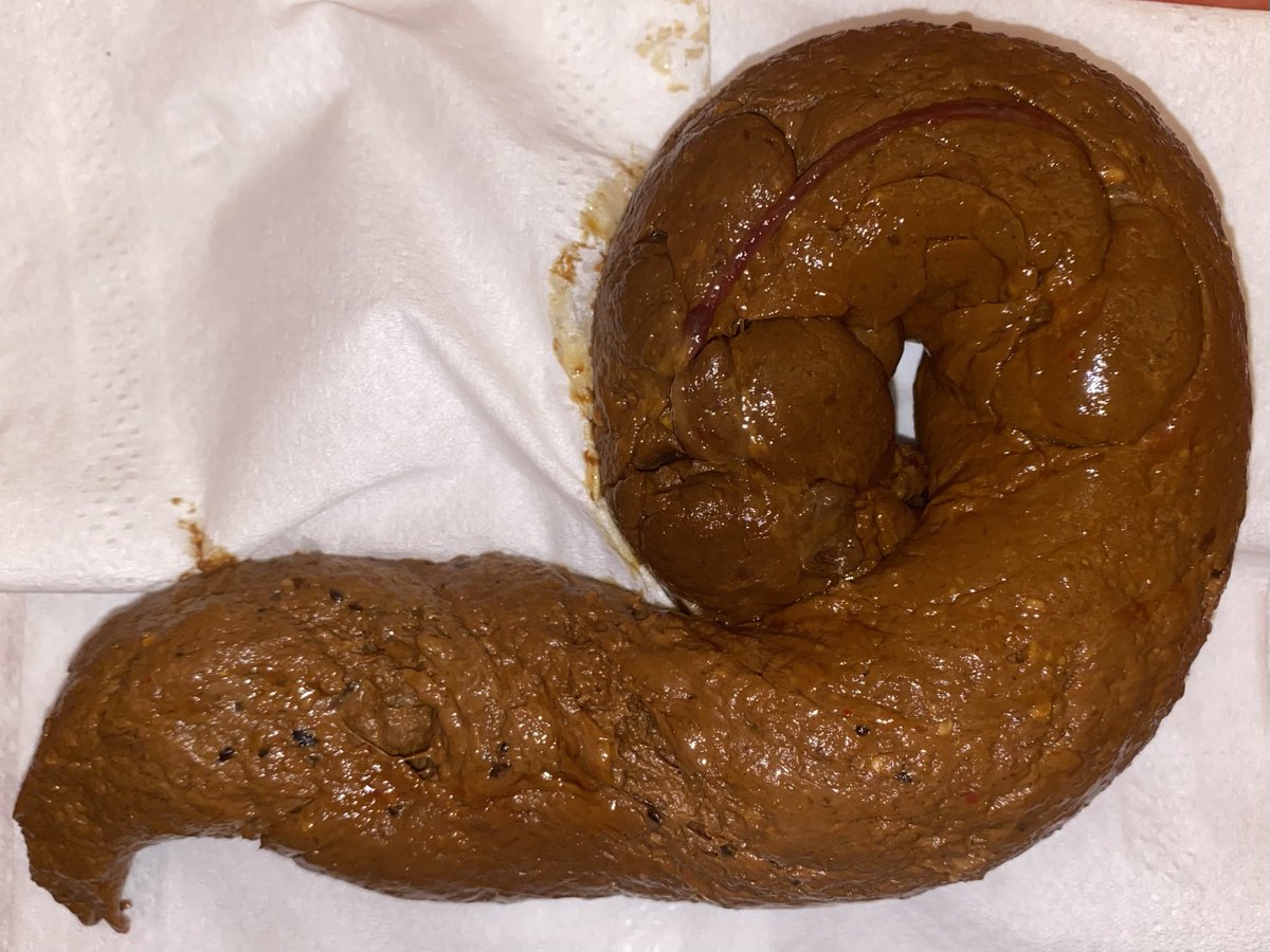 なんだか今にも画面から飛び出してきそうですよね💩