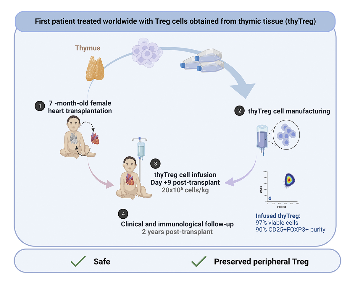 Journal of Experimental Medicine (@jexpmed) on Twitter photo A study from <a href="/lab_lir/">LIR lab-Madrid #immunology</a> has treated the first patient worldwide with a new therapy consisting of Tregs purified from thymic tissue (thyTreg). No adverse effects and preserved Tregs are reported in a heart-transplant child after #thyTreg administration. bit.ly/3FFeorG A study from <a href="/lab_lir/">LIR lab-Madrid #immunology</a> has treated the first patient worldwide with a new therapy consisting of Tregs purified from thymic tissue (thyTreg). No adverse effects and preserved Tregs are reported in a heart-transplant child after #thyTreg administration. bit.ly/3FFeorG