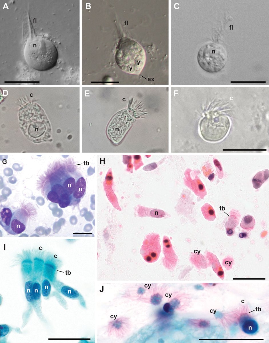 Lophomonas as a respiratory pathogen—jumping the gun tinyurl.com/vzhfh56d 'images and videos from human specimens do not represent true Lophomonas and are predominantly misidentified ciliated epithelial cells' @ASMicrobiology