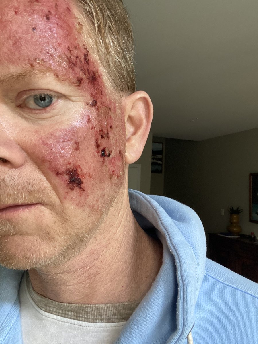 Jamie Campbell tweet media