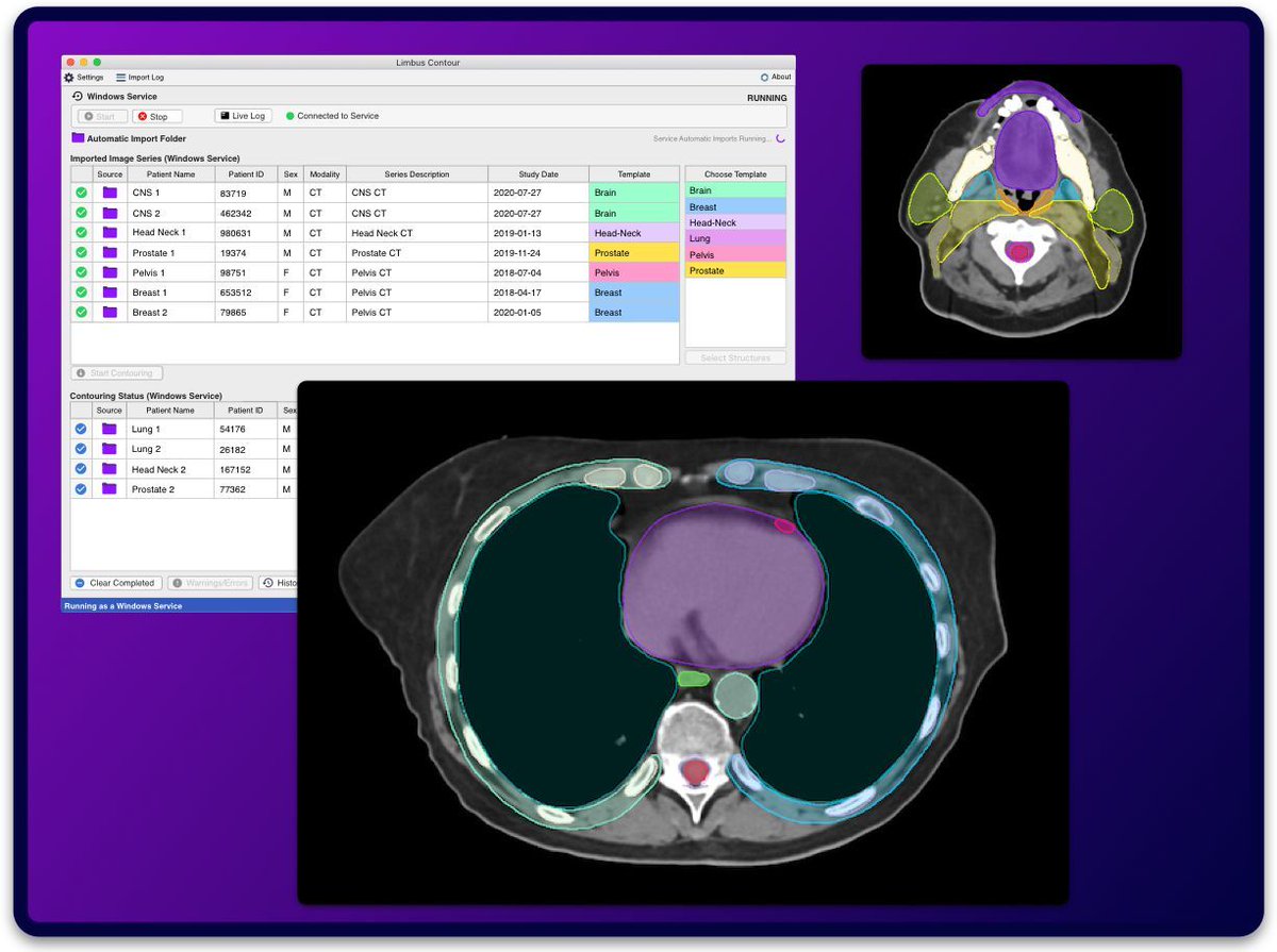 🔬 AI-based Auto-segmentation in #RadOnc via Limbus Contour v.1.6.0 by Dr. Sarria &amp; team. 🎯 Precision up, ⏱ time saved! 💊 Better dose distribution. Full paper: [link]

#LimbusContour #AI #MedPhys #Dosim #Radonc #AIinRadiationTherapy #MedicalInnovation